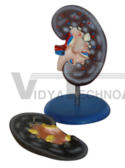 Kidney model (2 parts) Pharmaceutical and Anatomical Model Gifts